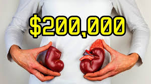 There is high demand for body parts-one kidney is at sh969millions